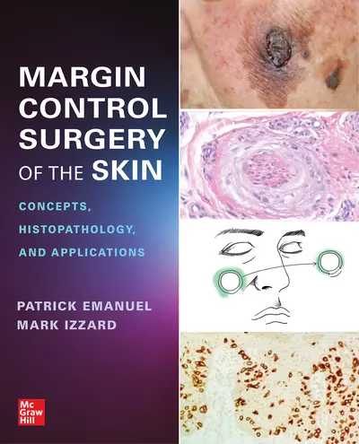 Margin Control Surgery of the Skin: Concepts, Histopathology, and Applications Margin Control Surgery of the Skin: Concepts, Histopathology, and Applications